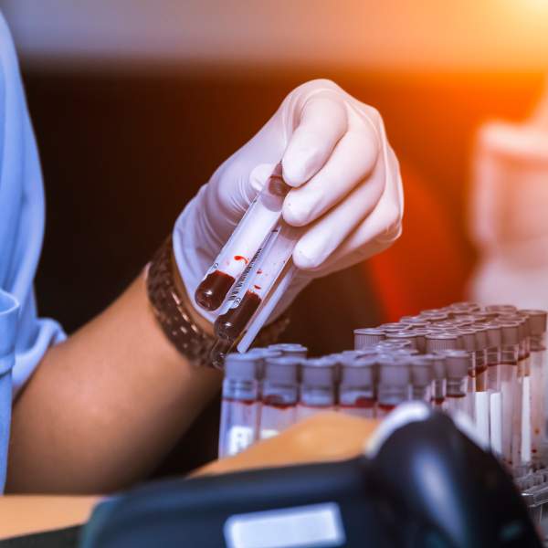 Biomarcadores Alzheimer